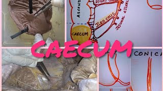 Anatomy of CAECUM [upl. by Ayra669]