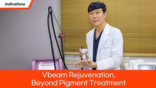 Vbeam Rejuvenation Beyond Pigment Treatment [upl. by Eintruoc]