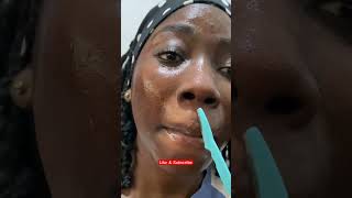 Dermaplaning at home part 2 dermaplaningfacial dermaplaning skincareroutine [upl. by O'Toole]