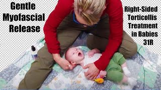 31R Gentle Myofascial Release RightSided Torticollis Treatment in Babies [upl. by Ailido]