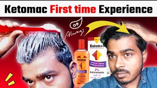 Ketomac 2 First time use Experience  Dandruff Shampoo  Control Flaking Scaling amp itching [upl. by Kress]