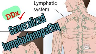 Approach to Diagnosing Generalized Lymphadenopathy [upl. by Naga743]