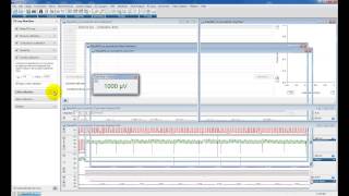 Analysing Pressurevolume PV loops using ADInstruments LabChart Pro [upl. by Camila]