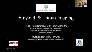 Amyloid PET Brain Imaging [upl. by Marozik194]