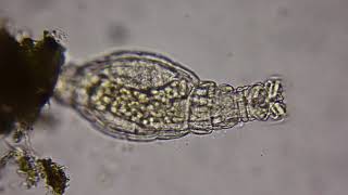 Rotifer under a microscope [upl. by Raimundo]