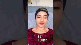 Plump Your Pout  Lip Fillers  Sarayu Clinics filler [upl. by Heaps728]