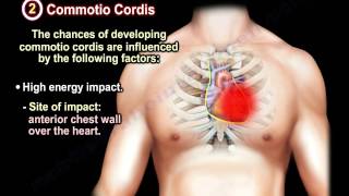 Sudden Cardiac Death In Athletes  Everything You Need To Know  Dr Nabil Ebraheim [upl. by Adnirb844]