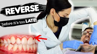 How To Treat Gum Disease [upl. by Eerej92]