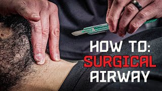 How to Emergency Surgical Cricothyrotomy [upl. by Maupin674]