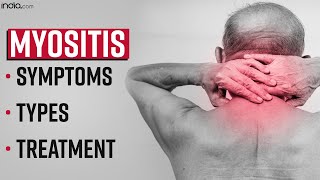 What is Myositis Know What It Is Symptoms Types And Treatment  Samanatha Ruth Prabhu [upl. by Ominorej]