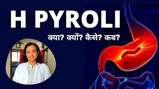 H Pylori Test in Hindi  HPylori Test क्या हैं कैसे किया जाता है [upl. by Sello]