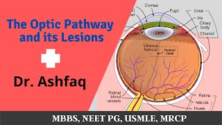 The Optic Pathway and its Lesions  MBBS NEXT PG USMLE MRCP [upl. by Fortna489]