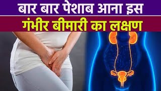 I Tried 10 Home Remedies for Frequent Urination and You Wont Believe What Happened [upl. by Hamilton]