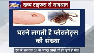 Scrub Typhus a new disease in Bhopal  Sawal Aap Ka Hai [upl. by Hans]