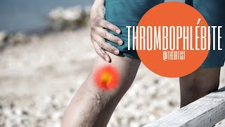 Comment traiter les thrombophlébites et caillots des veines par radiologie interventionnelle [upl. by Monty327]