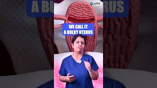 What You Need To Know About Adenomyosis  Dr Deepthi Jammi [upl. by Kajdan415]