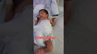 After laparotomy reels newborn newbornbabymoments baby cutebabycarebaby cute niceness [upl. by Pasco]