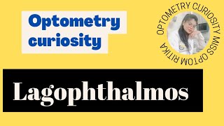 Lagophthalmos In Hindi हिन्दी etiology clinical features complicationTreatment by Miss optom 😍 [upl. by Anihc]