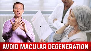 How to Prevent Macular Degeneration – Dr Berg [upl. by Caterina]