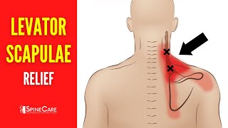 How to Fix Levator Scapulae Pain FOR GOOD [upl. by Drescher315]