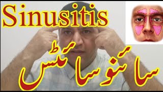 What is causessymtoms and treatment for sinus infectionSinusitis blocked nose ka ilajurduhindi [upl. by Osric]