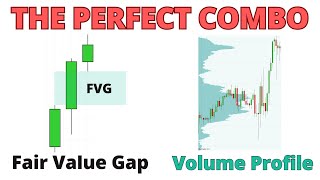 Fair Value Gap  Volume Profile The Perfect Combo for Smart Money Trading [upl. by Llesig408]