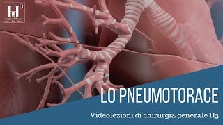 Lo pneumotorace  quadro clinico diagnosi e terapia [upl. by Anivad193]