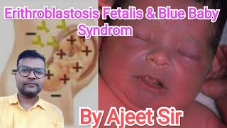 Erithroblastosis Fetalis and Blue baby syndrom By Ajeet Sir [upl. by Hareehahs]