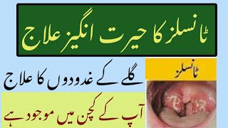 Tonsils ka desi ilaj Tonsils treatment at home home remedies Health and Waziaf Info [upl. by Marder656]