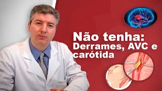 Dr Alexandre Amato Revela os Segredos da Prevenção de Derrames [upl. by Yrrum205]