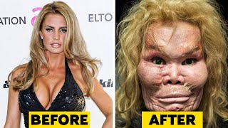 20 Celebrity Plastic Surgery Disasters [upl. by Weir]