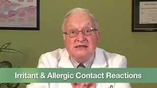 Irritant amp Allergic Contact Reactions [upl. by Cuyler]