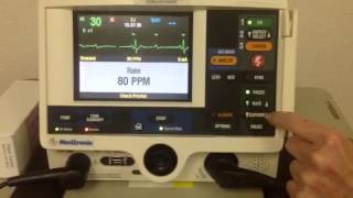 How to use the Pacing Option on the defibrillator [upl. by Poock65]