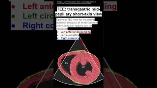 TEE transgastric mid papillary shortaxis view [upl. by Applegate57]