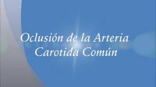 Oclusión de la Arteria Carótida Común Carotid thrombosis [upl. by Tarsus554]