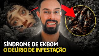 Síndrome de Ekbom A Infestação Delirante – Causas Diagnóstico e Tratamento [upl. by Des131]