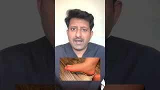 Flat Feet in kids  What parents need to know  Dr Jeya Venkatesh [upl. by Naitsirhc463]