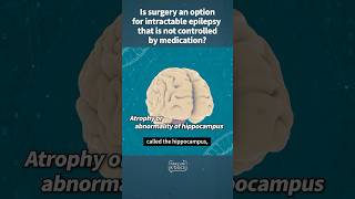 Is surgery an option for intractable epilepsy that is not controlled by medication [upl. by Acus]