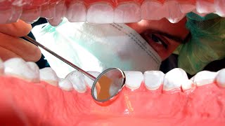 How to Care for Your Gums After a Parodontal Treatment  What Are the Best Practices for Promoting [upl. by Introk]