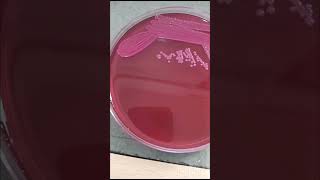 Klebsiella pneumonia grow in macConkey agar for blood cs  Microbiologist  bacterilogh microb mp [upl. by Eentruoc]