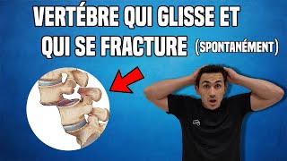 TRAITEMENT DU SPONDYLOLISTHÉSIS LOMBAIRE  EXERCICE KINÉ [upl. by Olonam601]