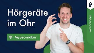 Hörgeräte im Ohr 2024 Mini Hörgeräte Preise Erfahrungen amp mehr [upl. by Aillimac]