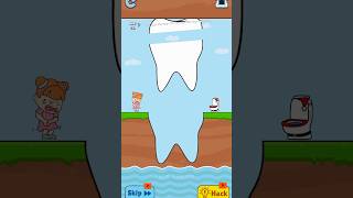 Slice this teeth🦷 to save trending viralvideo funny shorts [upl. by Brandyn]