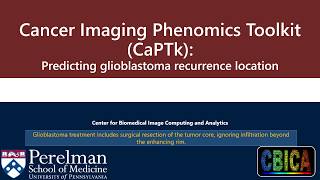 CBICA CaPTk Predicting Glioblastoma Recurrence Location [upl. by Onafets811]