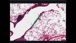 Respiratory System Histology  Lung Acinus [upl. by Halley]