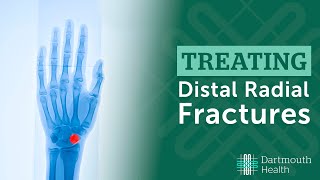 Treating Distal Radius Fractures at Dartmouth Health [upl. by Neeluj653]