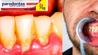 Parodontax Toothpaste  GSK  Plaque  Bad Breath  Gums Problem  Sodium Bicarbonate [upl. by Woodie]