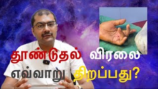 What is the treatment of choice for trigger finger Dr Soundar I Tamil [upl. by Ardelis]