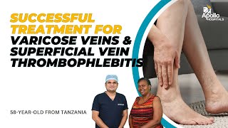 Tanzanian Patient Successfully Recovers From Severe Leg Pain  Endovenous Glue Therapy [upl. by Paxton]