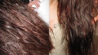 ✿⊱╮Cheveux gras  solutions naturelles [upl. by Nnyl616]